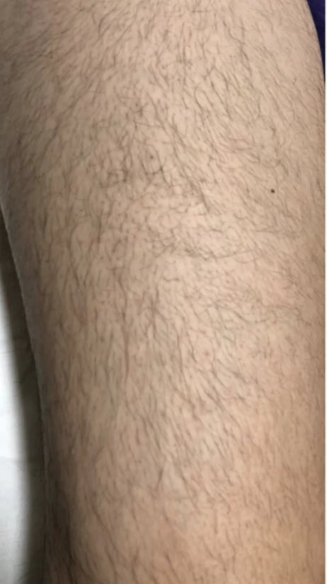 Jambes, avant