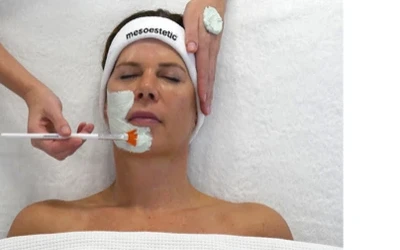 Imperfections, étape 2 : exfoliation